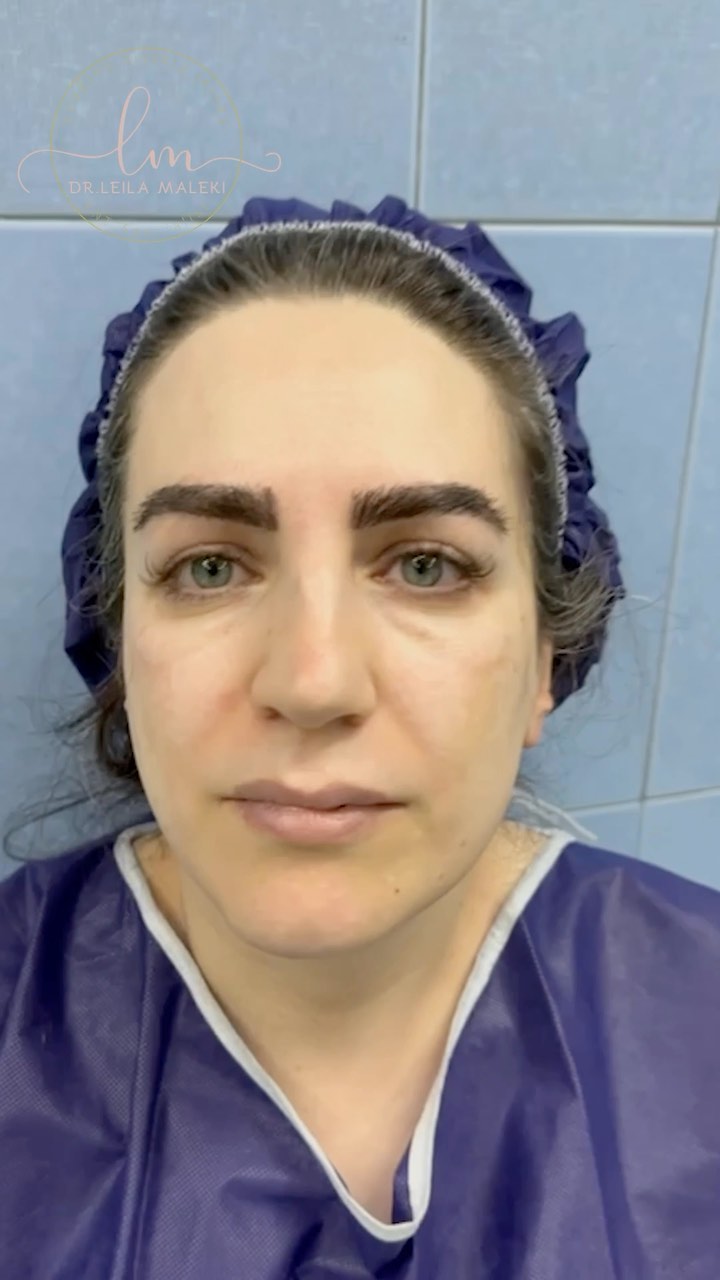 ویدیوی دکتر لیلا ملکی